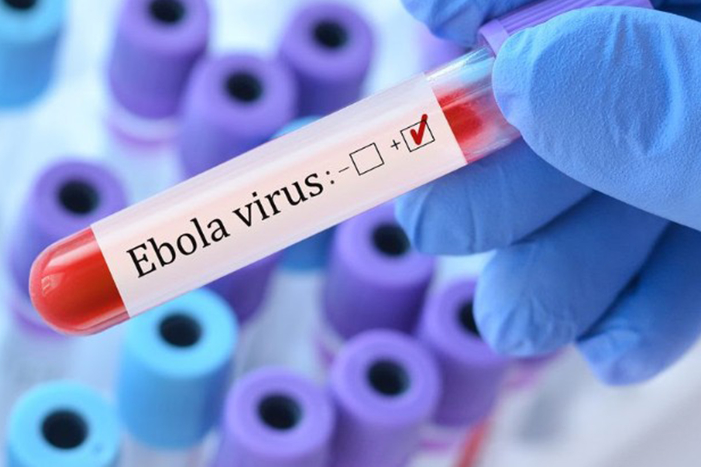 Kongo’da Ebola salgınında can kaybı 2 bin 325'e yükseldi