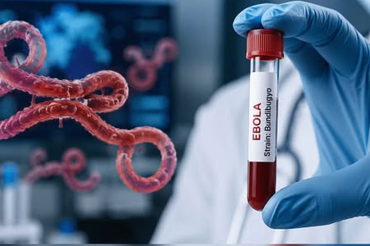 Ebola salgınına karşı acil önlem çağrısı