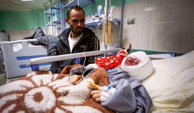 Seca, İsrail saldırısının acısını yüzünde taşıyor